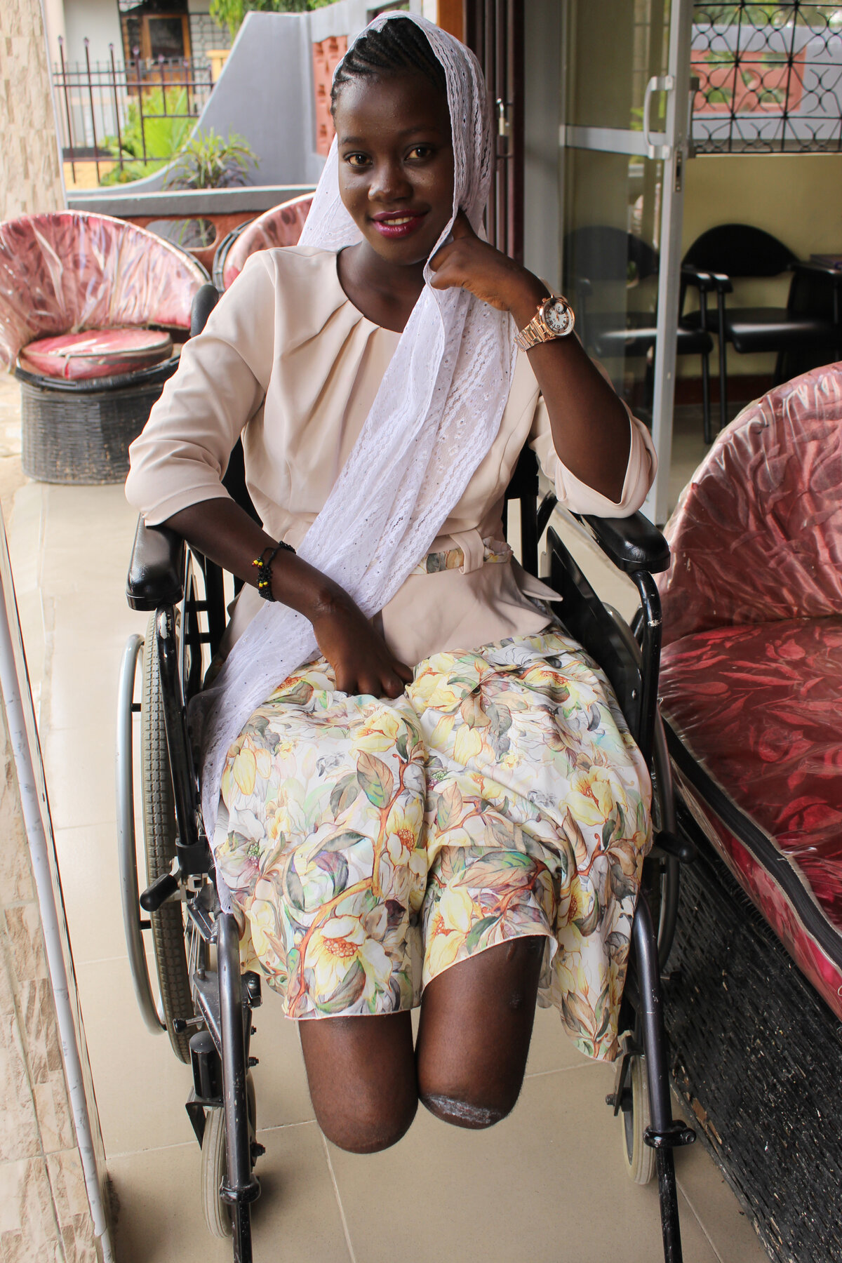 Asia, 20 ans, de Mwanza, Tanzanie : amputée bilatérale sans 9 doigts, elle a commencé à travailler dans un projet SwissLimbs pour motiver d'autres personnes handicapées à reprendre espoir. Photo : © SwissLimbs