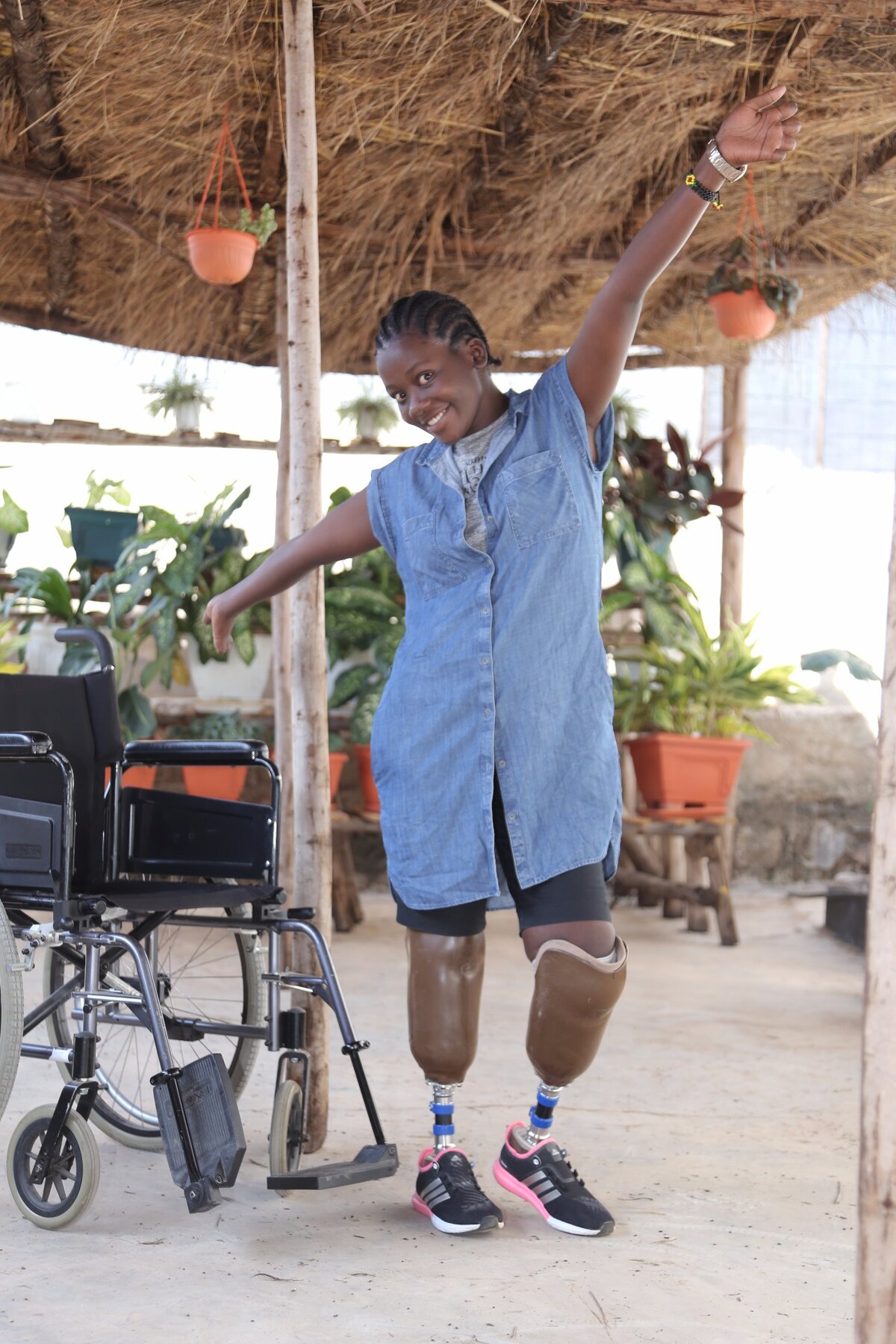 Asia, 20 ans, de Mwanza, Tanzanie : amputée bilatérale sans 9 doigts, avec ses nouvelles prothèses. Photo : © SwissLimbs